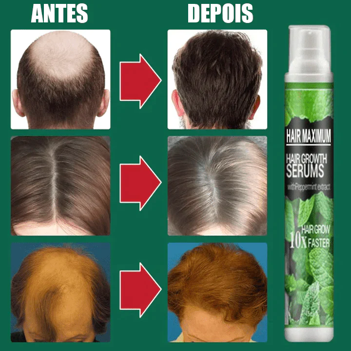 (Pague 1 e Leve 4) Hair Maximium® - Spray de Crescimento Capilar